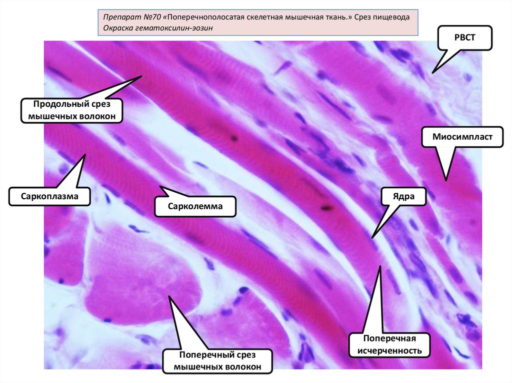 Поперечная скелетная ткань. Поперечнополосатая Скелетная мышечная ткань гистология. Поперечнополосатая Скелетная мышечная ткань препарат. Поперечно полосатая мышечная ткань гематоксилин эозин. Скелетная мышца гистология.