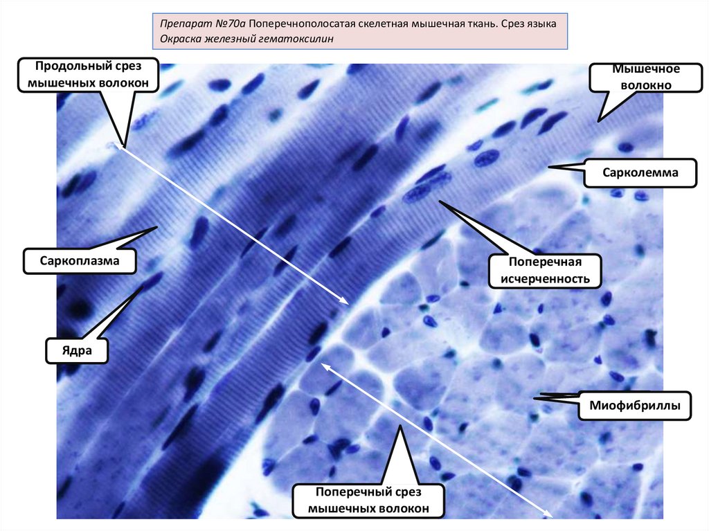 Поперечно полосатая сердечная мышечная ткань гистология рисунок