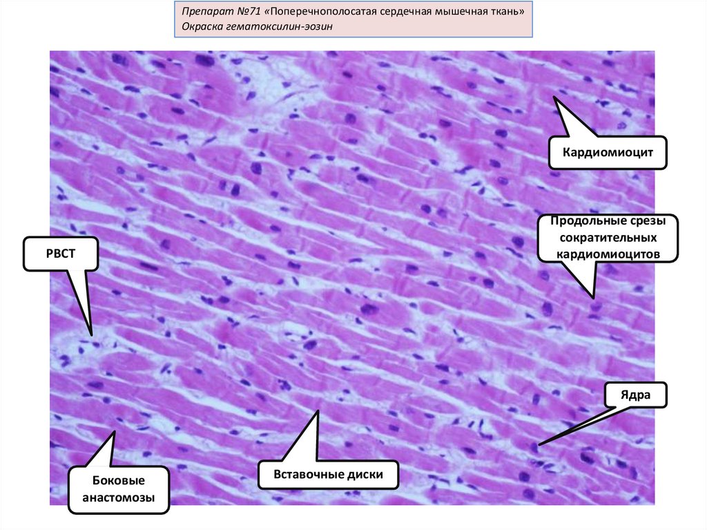 Поперечно полосатая сердечная мышечная ткань гистология рисунок