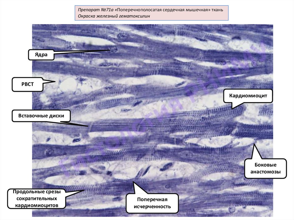 Поперечно полосатая сердечная мышечная ткань гистология рисунок