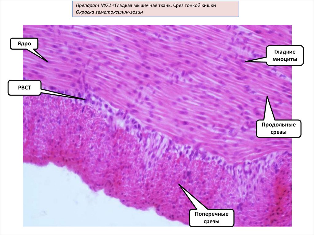 Препараты тканей. Гладкие миоциты гистология препарат. Гладкая мышечная ткань гистология препарат. Гладкая мышечная ткань тонкой кишки гистология препарат. Гладкая мышечная ткань гематоксилин эозин.