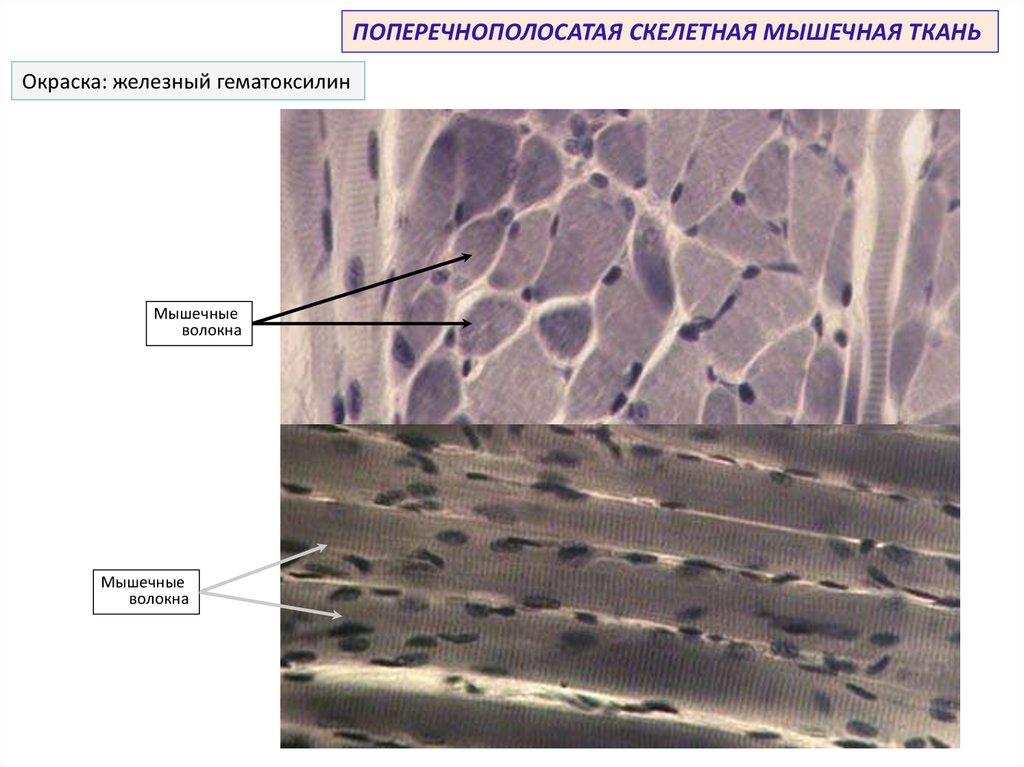 Ткань языка. Поперечнополосатая мышечная ткань Железный гематоксилин. Скелетная мышечная ткань Железный гематоксилин. Поперечно полосатая Скелетная мышечная ткань Железный гематоксилин. Скелетная мышечная ткань окраска железным гематоксилином.