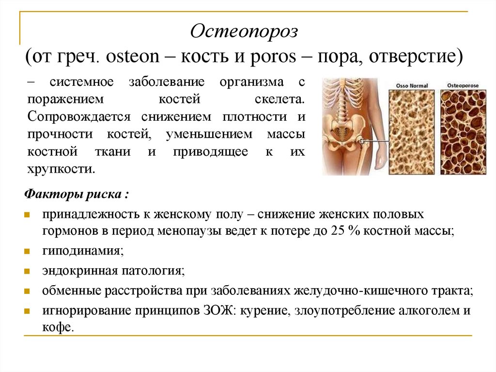 Факторы риска остеопороза. Остеопороз картинки для презентации.