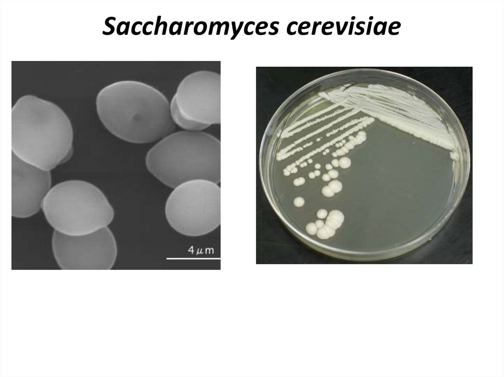 Антитела к сахаромицетам. Saccharomyces cerevisiae колонии. Дрожжи Saccharomyces cerevisiae. Saccharomyces cerevisiae микроскопия. Saccharomyces cerevisiae строение.