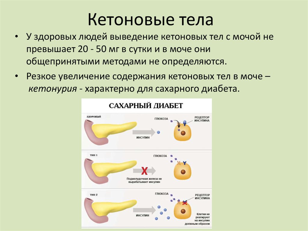 Кетоновые тела презентация