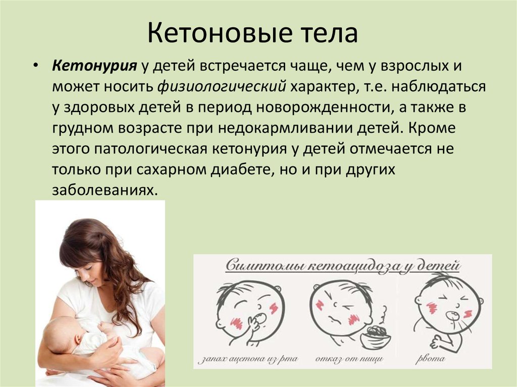 Кетоны в моче у мужчины. Кетонурия. Причины кетонурии. Причины кетонурии в моче. Кетоновые тела в организме.
