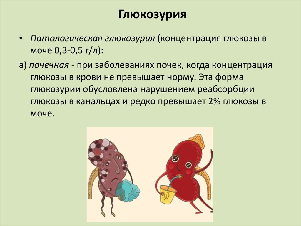 Глюкозурия. Почечная глюкозурия биохимия. Патологическая глюкозурия. Причины развития глюкозурии.