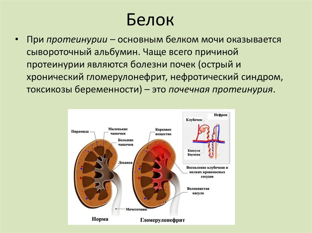 Созылмалы гломерулонефрит презентация