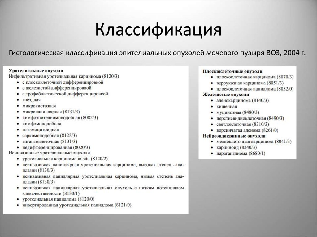 Мкб 10 рак мочевого. Опухоли мочевого пузыря классификация. Папиллярная уротелиальная карцинома. Папиллярная уротелиальная карцинома мочевого пузыря g2. Классификация опухолей схема.