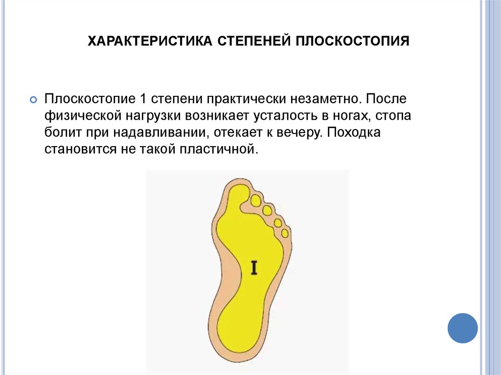 Плоскостопие 2 степени. Стопа с 1 степенью плоскостопия. Продольное плоскостопие 1 степени. Плоскостопие 1-3 степени. Продольное плоскостопие 2-3 степени у детей.