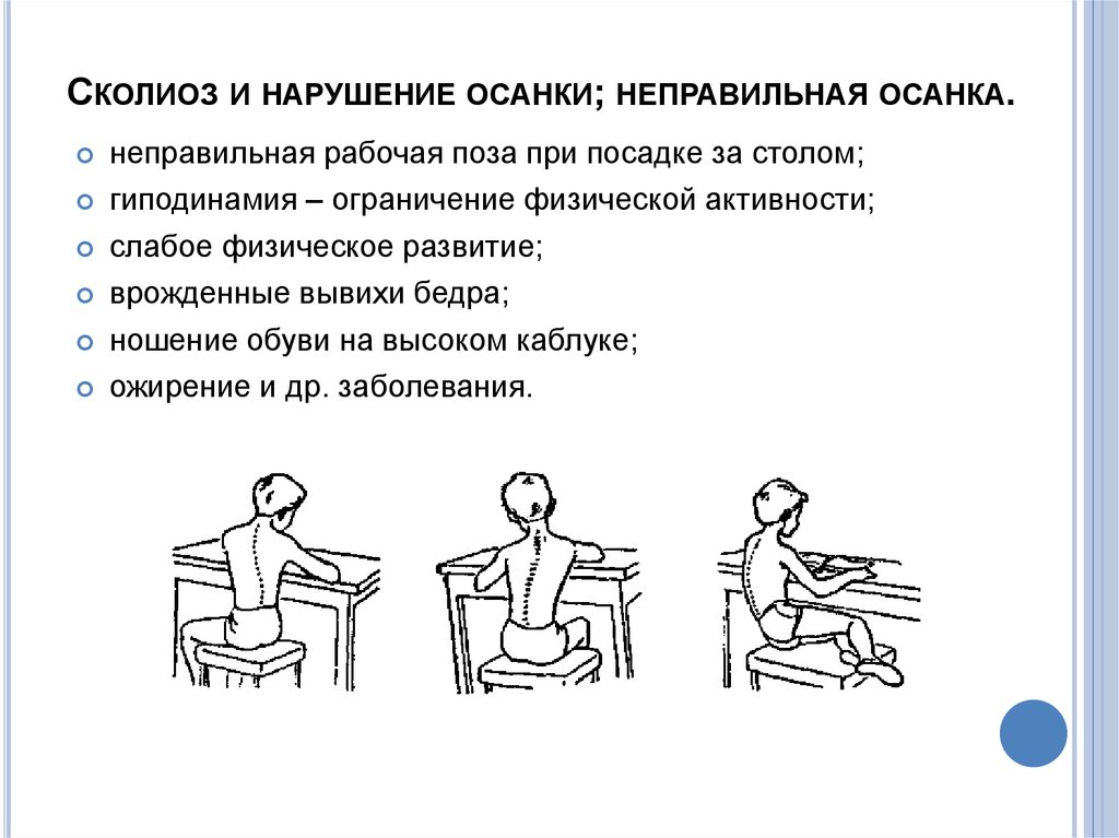 Перечислите нарушения осанки. Заболевания при неправильной осанке. Нарушение осанки сколиоз. Заболевания при неправильной посадке обучающихся. Основная причина нарушения осанки это гиподинамия.