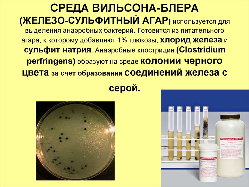 Экспериментатор решила установить какое количество бактерий. Среда Вильсона Блера клостридии. Среда Вильсона Блера микробиология. Клостридии питательные среды. Анаэробных клостридий на среде Вильсона-Блера.