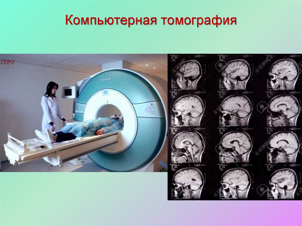 Кт черкесск. Компьютерная томография в неврологии. Первый компьютерный томограф. Интернет компьютерная томография. Компьютерные томографы модели.