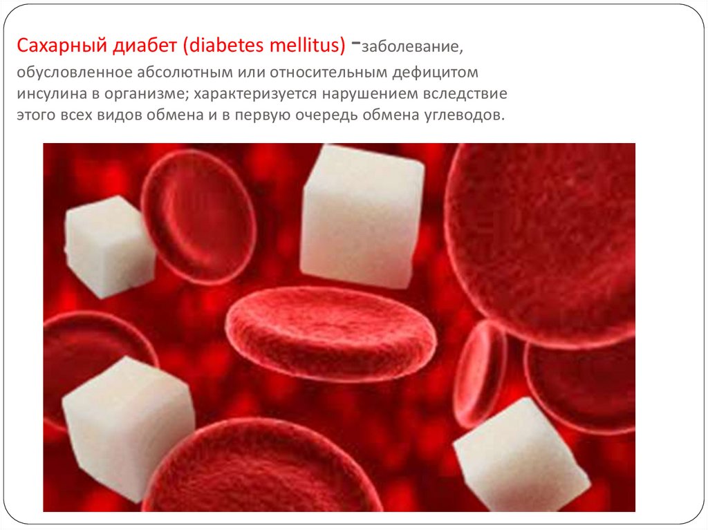 Сахарный диабет (diabetes mellitus) -заболевание, обусловленное абсолютным или относительным дефицитом инсулина в организме;