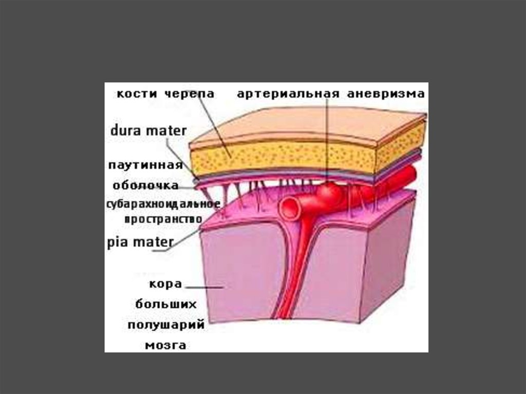 Субарахноидальное пространство. Васкуляризованное субарахноидальное пространство. Субарахноидальное пространство располагается под. Подпаутинное субарахноидальное пространство.