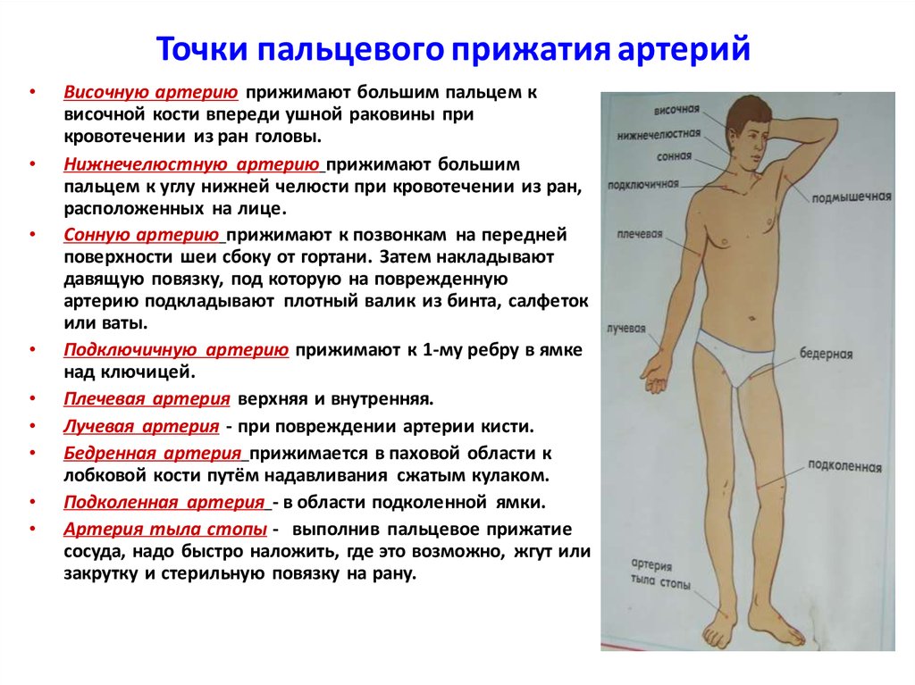 Рисунок названием артерий и костей к которым осуществляется прижатие артерии при кровотечении