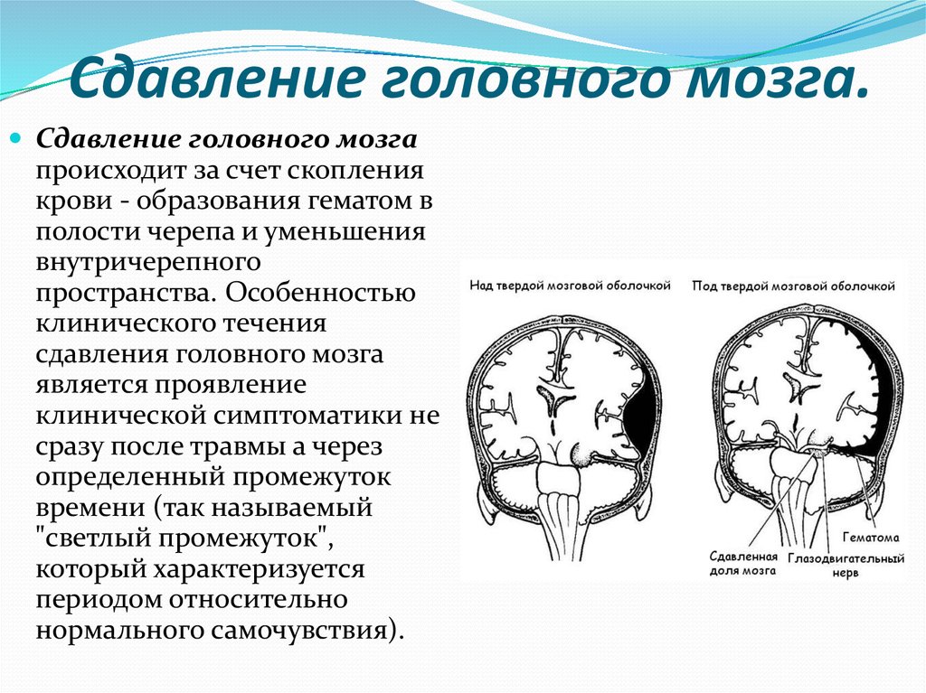 Сдавление мозга признаки. Сдавление головного мозга внутричерепными гематомами. Давление головного мозга. Компрессия головного мозга. Сжатие головного мозга.