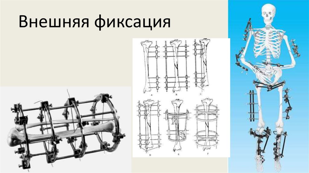 Схема центра илизарова