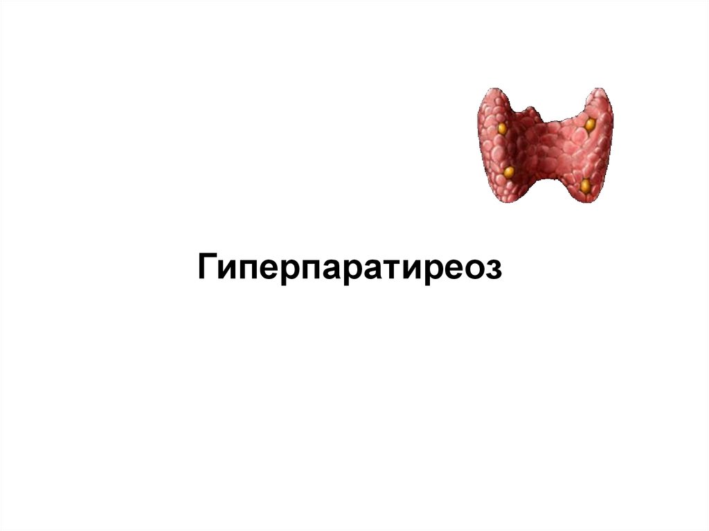 Гиперпаратиреоз