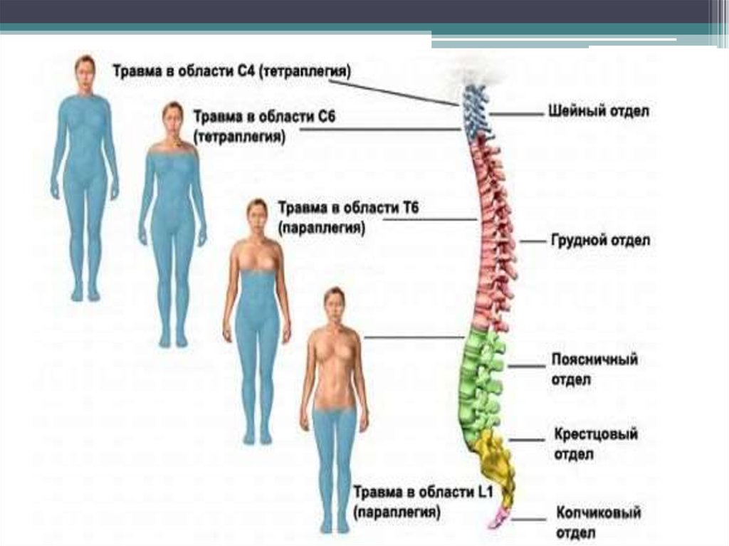 Травмы нервной системы презентация