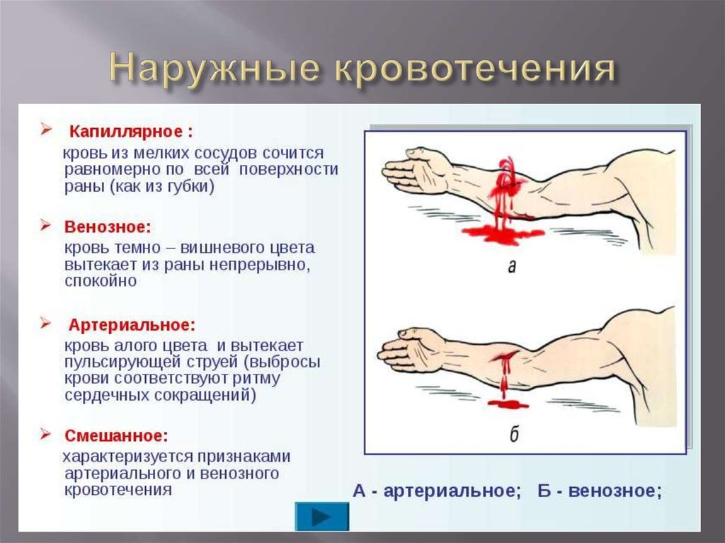 Наружные кровотечения