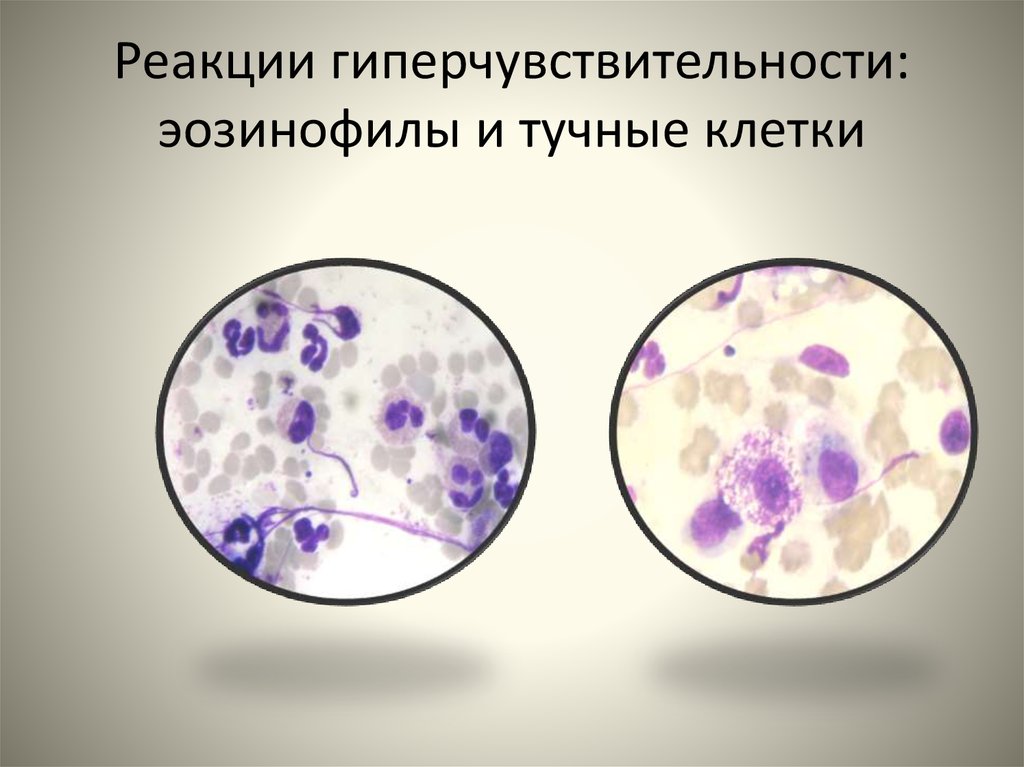 Реакции гиперчувствительности: эозинофилы и тучные клетки