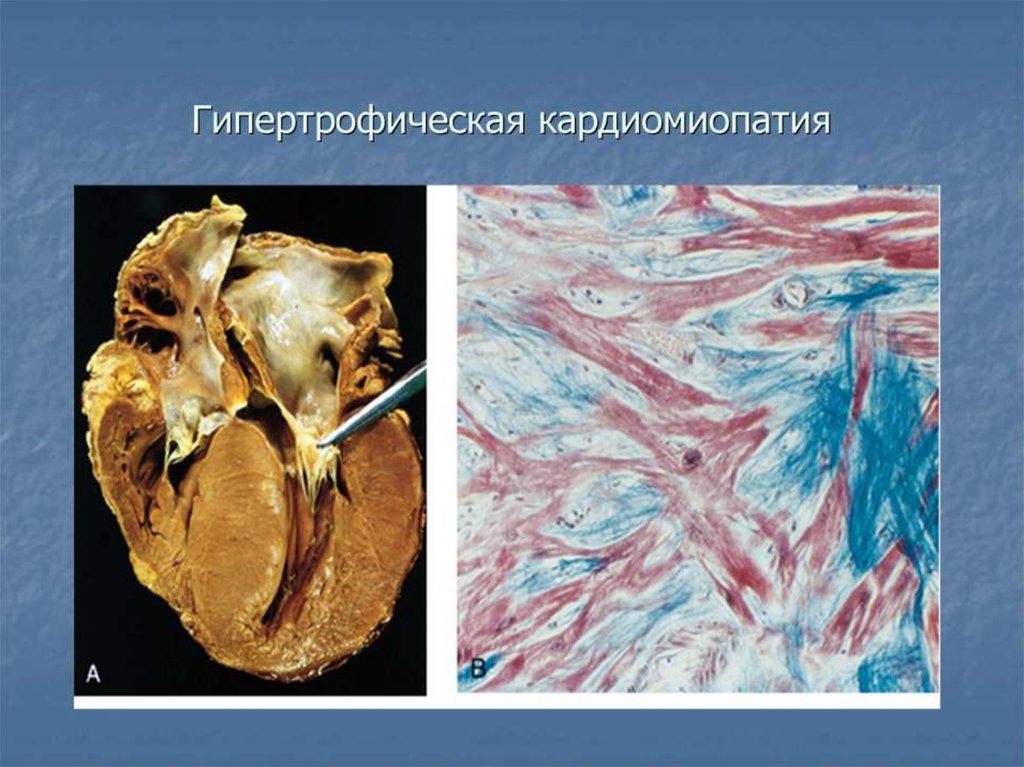 Тигровое сердце рисунок