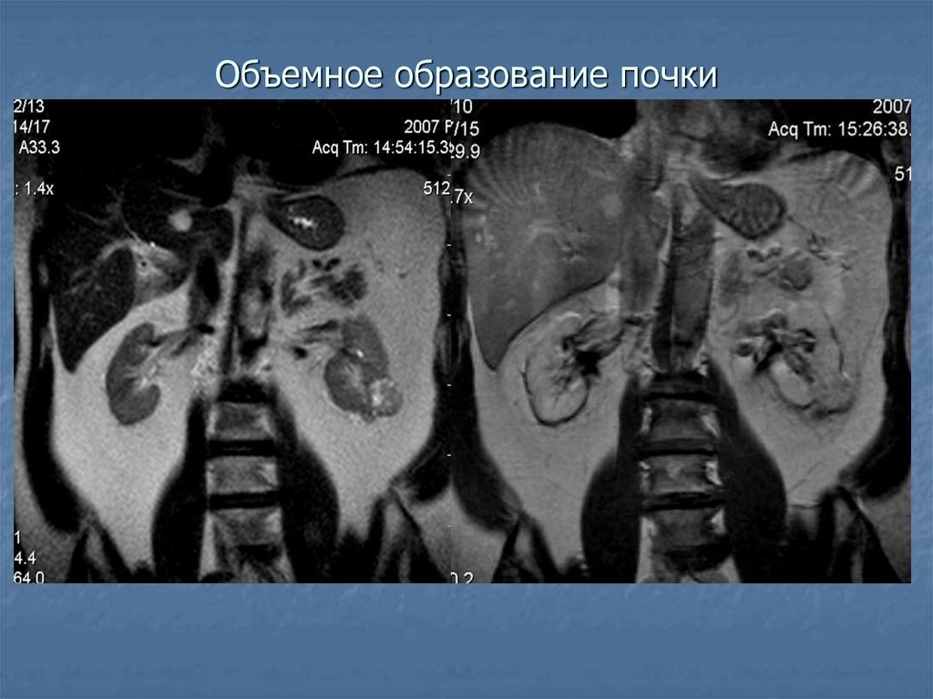 Картина объемного образования