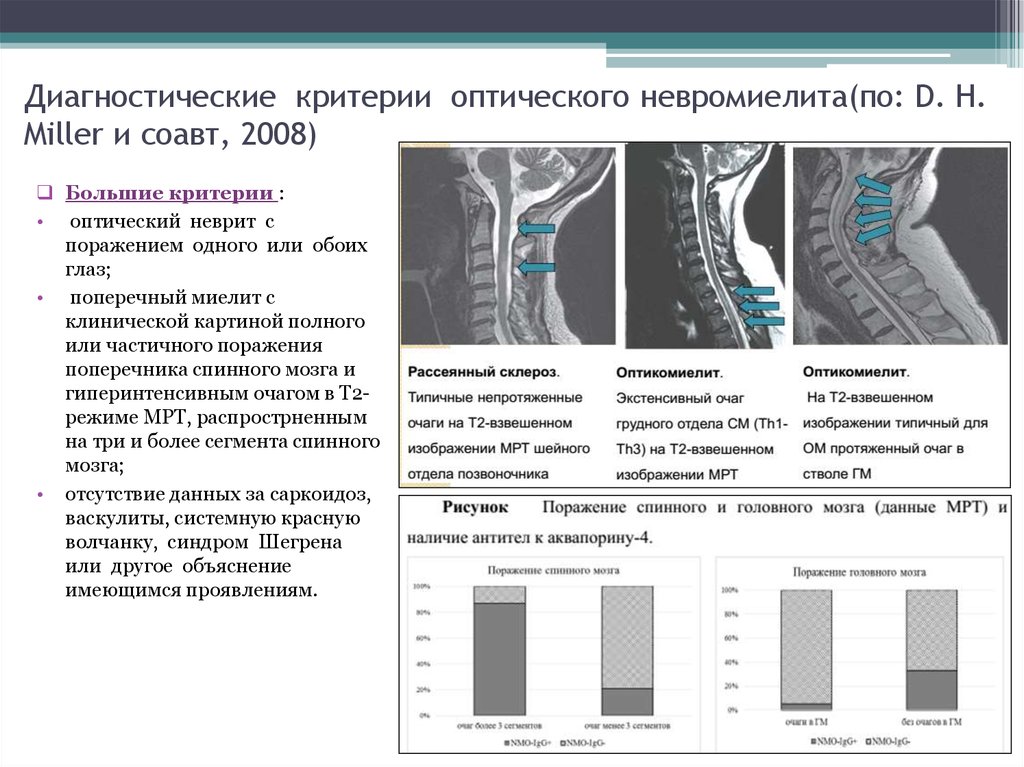 Оптикомиелит