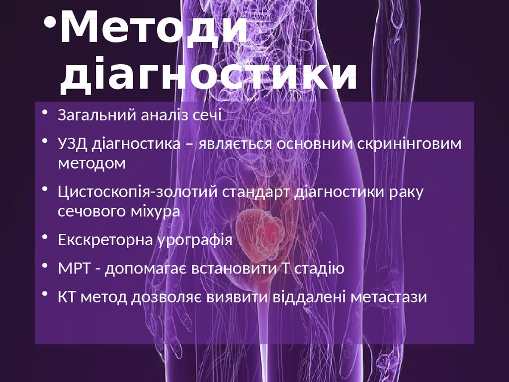 Методи діагностики