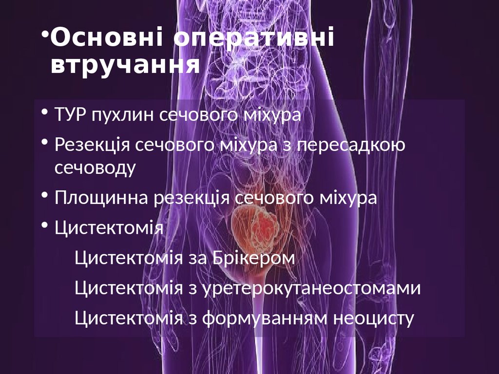 Основні оперативні втручання