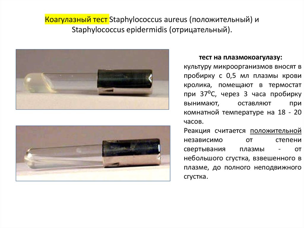 Коагулазный тест Staphylococcus aureus (положительный) и Staphylococcus epidermidis (отрицательный).