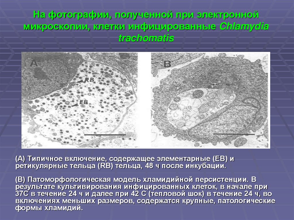 Хламидии тепловой шок. Хламидии микрофотография. Хламидия трахоматис микроскопия.