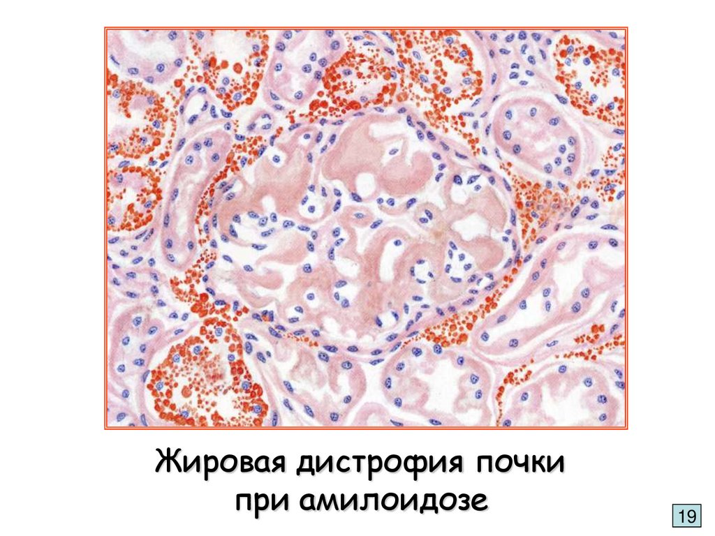 Альбом по патологической анатомии с рисунками