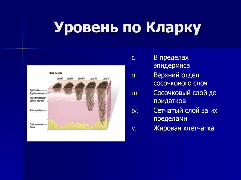 Уровни инвазии меланомы по кларку. Уровень инвазии по Кларку IV. Уровень инвазии по Кларку и Бреслоу. Уровень инвазии по Кларку 2 что это.