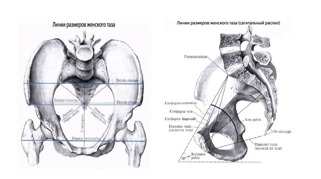 Размеры женского таза презентация