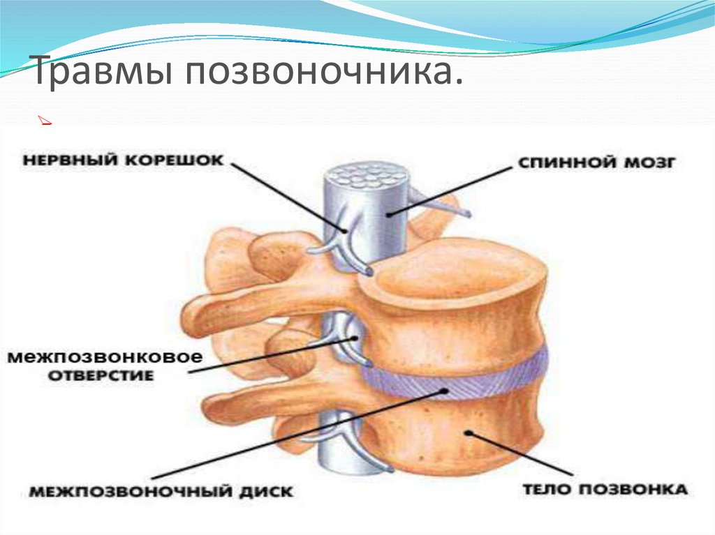 Сотрясение позвоночника. Повреждение позвоночника и спинного мозга. Типы повреждений спинного мозга.