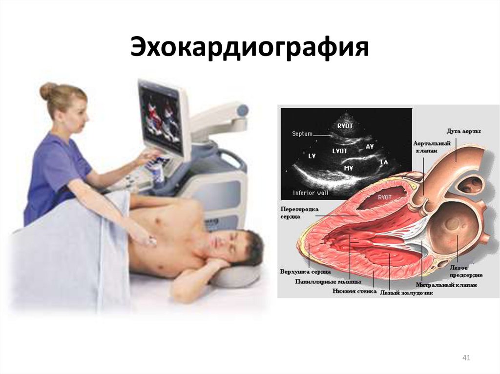 Эхо кг что это. Эхокардиография. Эхокардиография сердца. Аппарат для эхокардиографии сердца. Эхокардиография рисунок.