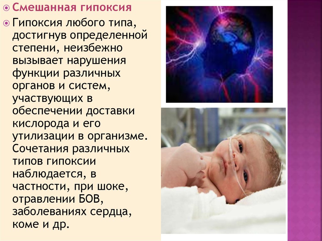 Гипоксия мозга у ребенка