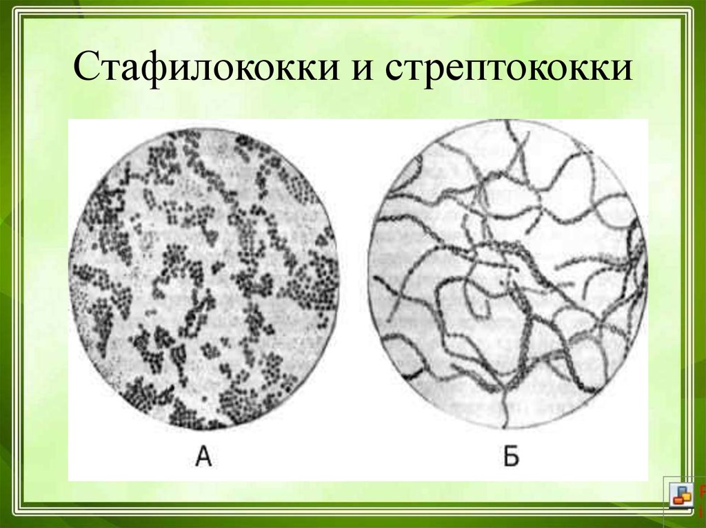 Тест стрептококк группы а. Стафилококки и стрептококки. Стрептококковые и стафилококковые инфекции.