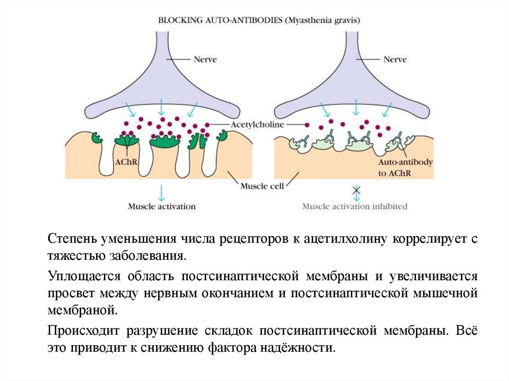 Миастения это простыми словами