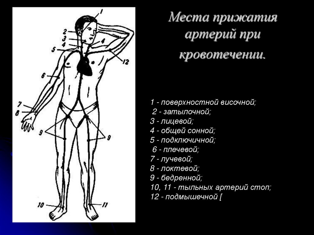 В каких местах можно. Точки пальцевого прижатия артерий рисунок. Места прижатия артерий при кровотечениях. Место придатия артерий. Точки прижатия артерий при кровотечении.