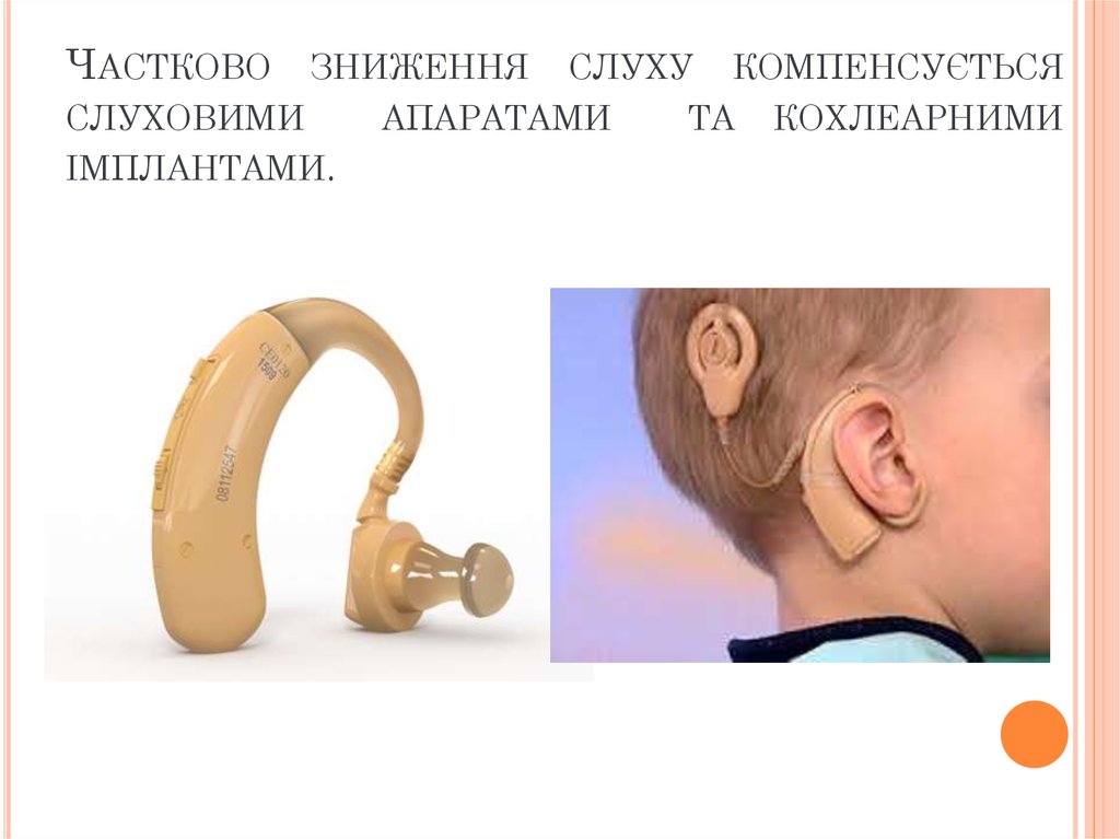 Частково зниження слуху компенсується слуховими апаратами та кохлеарними імплантами.