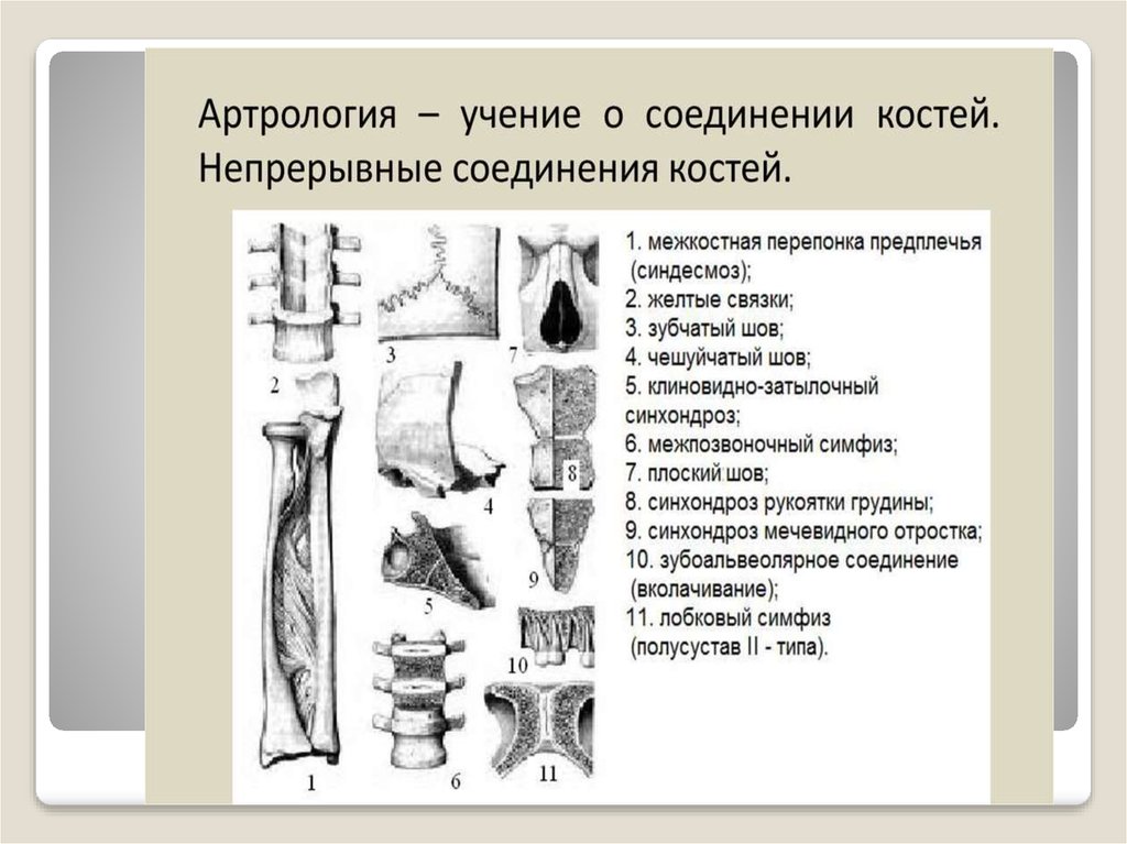 2 соединения костей примеры