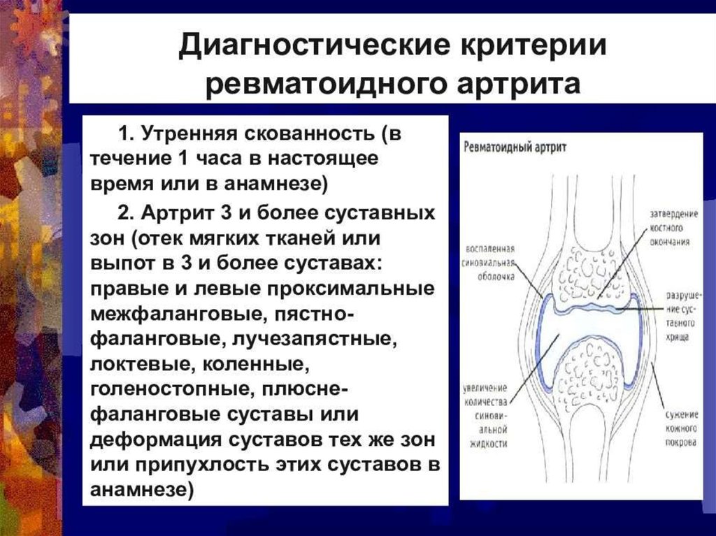 Ревматоидный артрит мышцы. Суставные поражения при ревматоидном артрите. Ревматоидный артрит клинические рекомендации 2020. Характерные суставные проявления ревматоидного артрита. Ревматоидный артрит симметричность поражения.