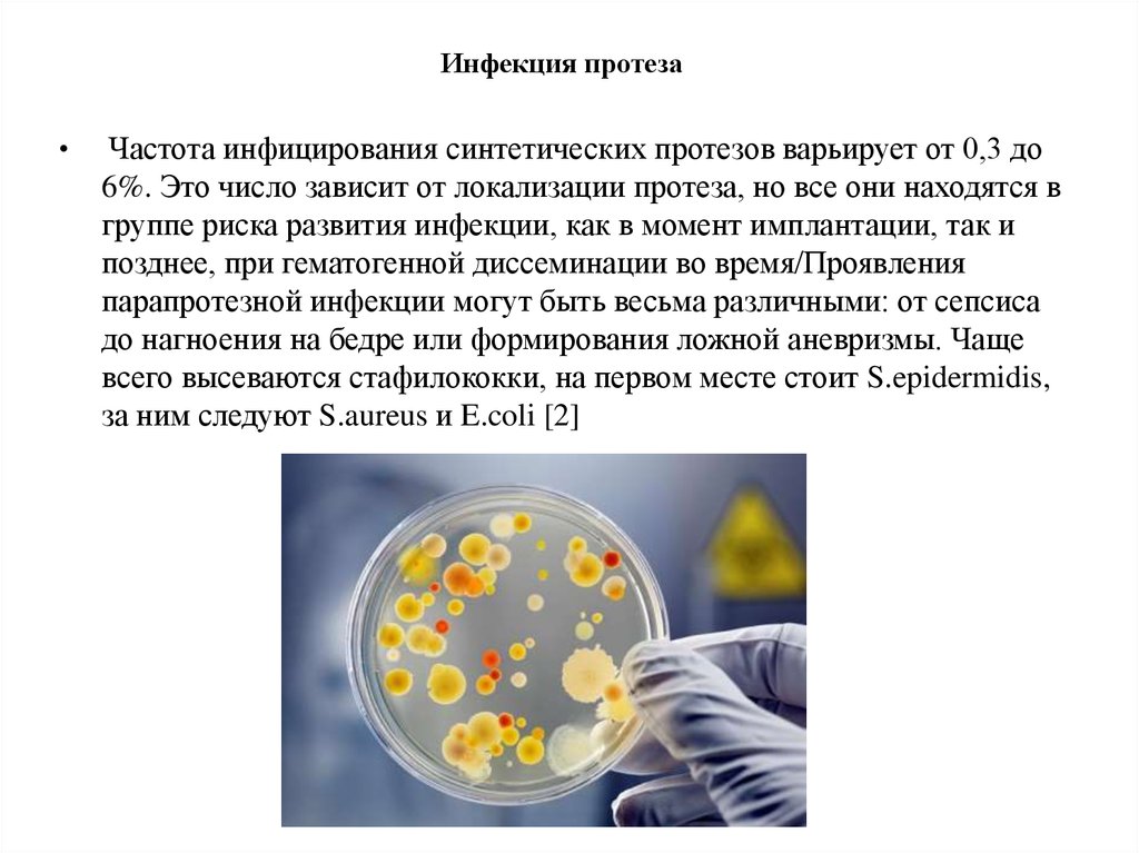 Исследование микрофлоры. Изучение микрофлоры. Исследование микрофлоры гноя. Гноеродная микробная Флора.