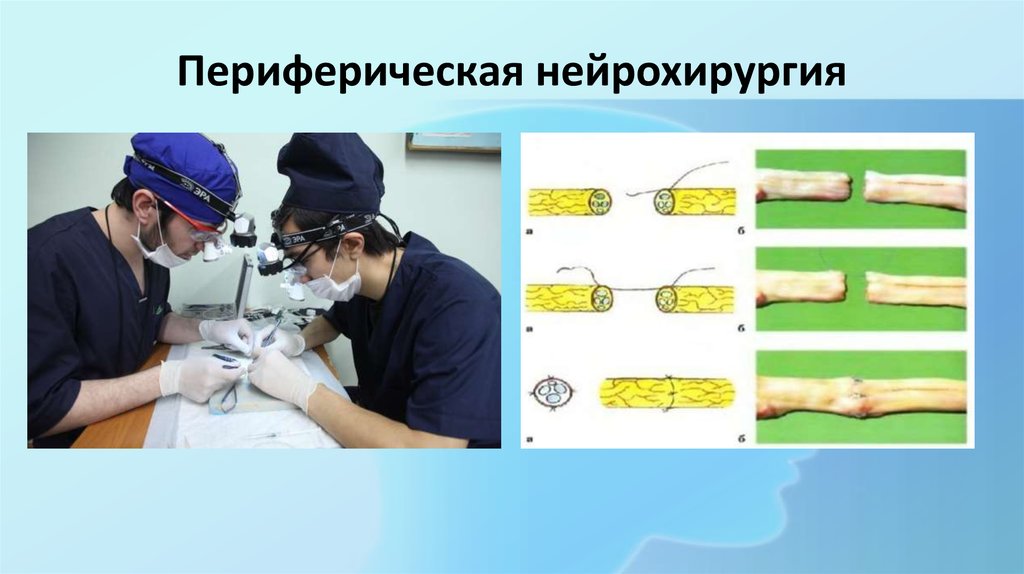 Эндоскопия в нейрохирургии презентация