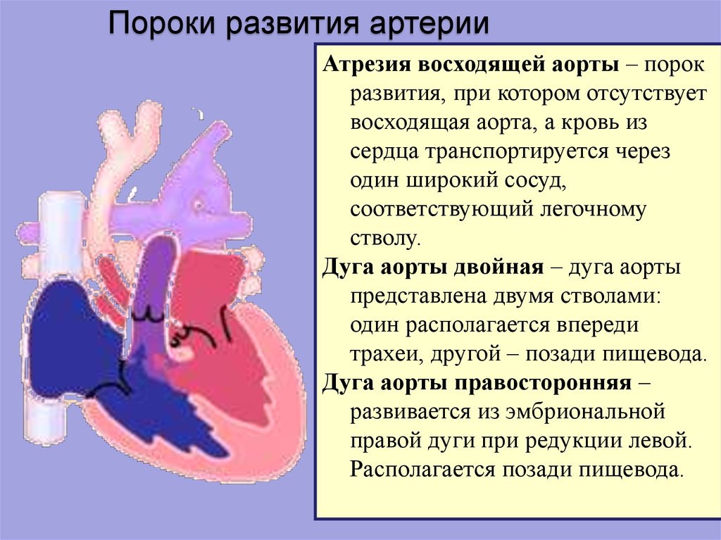 Дуги пищевода. Правосторонняя дуга аорты на кт. Артерии отходящие от дуги аорты рентген.