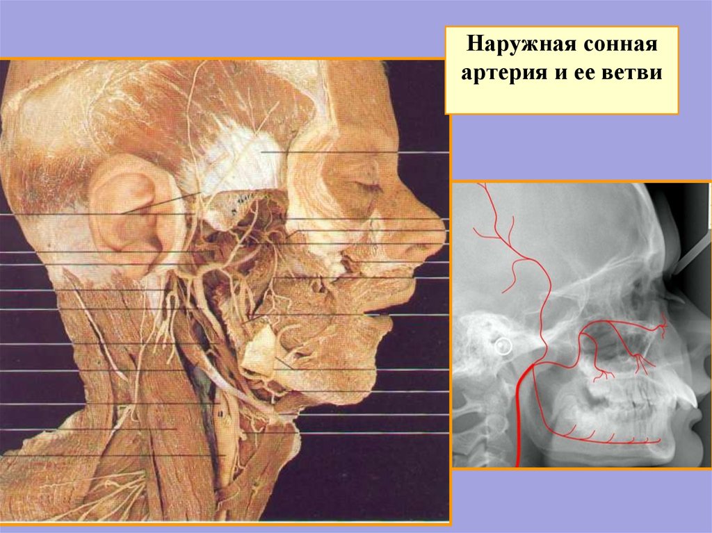 Наружная сонная артерия