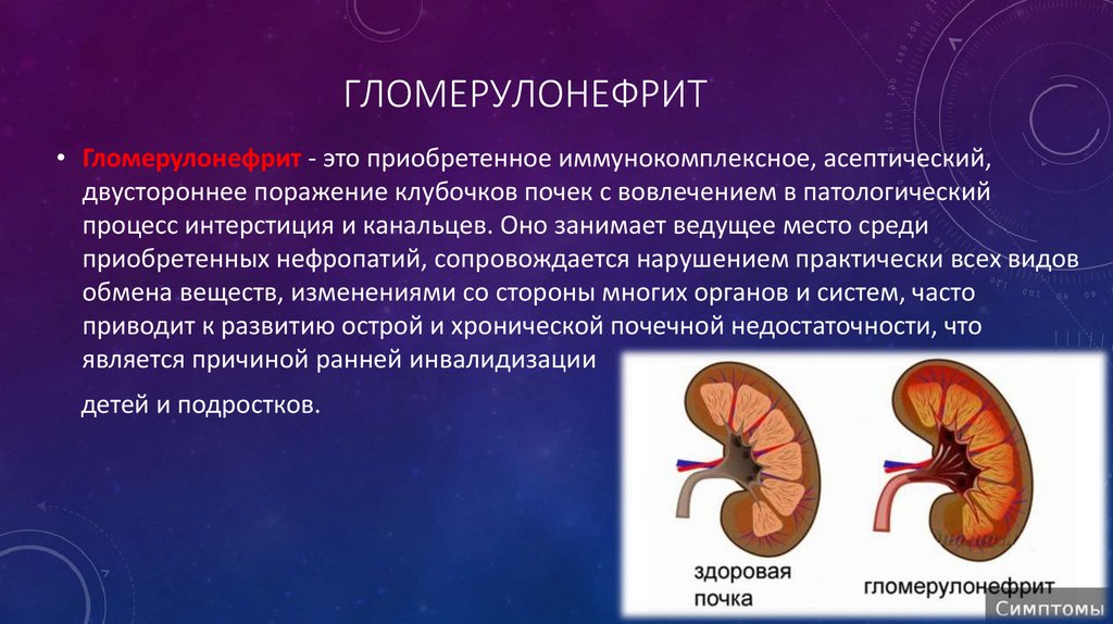 Гломерулонефрит пиелонефрит презентация